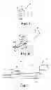 Fig. 03 - Apparatus and methods for internal surgical procedures