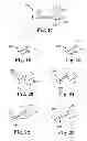 Fig. 07 - Apparatus and methods for internal surgical procedures