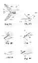 Fig. 08 - Apparatus and methods for internal surgical procedures