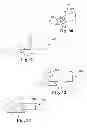 Fig. 09 - Apparatus and methods for internal surgical procedures
