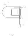Fig. 02 - APPARATUS FOR SKIN REDUCTION