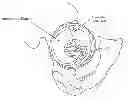 Fig. 01 - Method and apparatus for treating a hip joint, including the provision and use of a novel suture passer