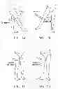 Fig. 02 - Method and apparatus for treating a hip joint, including the provision and use of a novel suture passer