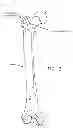 Fig. 04 - Method and apparatus for treating a hip joint, including the provision and use of a novel suture passer