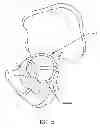 Fig. 06 - Method and apparatus for treating a hip joint, including the provision and use of a novel suture passer