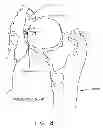 Fig. 09 - Method and apparatus for treating a hip joint, including the provision and use of a novel suture passer