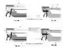 Fig. 41 - Method and apparatus for treating a hip joint, including the provision and use of a novel suture passer