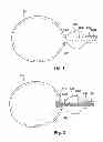 Fig. 02 - Methods, compositions and kits for performing anastomosis procedures in conjunction with a radical prostatectomy procedure