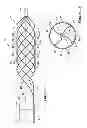 Fig. 02 - Expandable scaffold with cutting elements mounted thereto