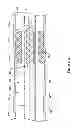 Fig. 06 - Expandable scaffold with cutting elements mounted thereto