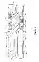 Fig. 08 - Expandable scaffold with cutting elements mounted thereto