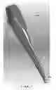 Fig. 02 - Apparatus and method for forming incisions in ocular tissue