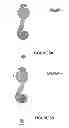 Fig. 07 - Apparatus and method for forming incisions in ocular tissue