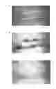 Fig. 07 - ACUPUNCTURE TOOL