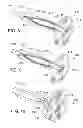 Fig. 07 - Heart occlusion devices