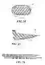 Fig. 08 - STIMULATION/SENSING LEAD ADAPTED FOR PERCUTANEOUS INSERTION