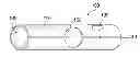 Fig. 01 - Vascular shield and delivery system