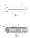 Fig. 03 - Vascular shield and delivery system