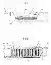 Fig. 02 - Sensor Actuated Stent