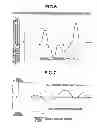 Fig. 06 - Device for improving vehicle behavior when steering