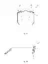 Fig. 02 - DEVICE AND METHOD FOR MEASURING PANTOSCOPIC TILT