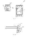 Fig. 04 - DEVICE AND METHOD FOR MEASURING PANTOSCOPIC TILT