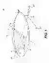 Fig. 02 - Lenticular airship and associated controls