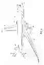 Fig. 02 - Method and system for distributed network of nanoparticle ink based piezoelectric sensors for structural health monitoring