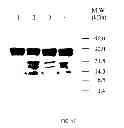 Fig. 31 - Methods and compositions for targeted imaging
