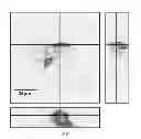 Fig. 06 - METHODS OF TREATING STROKE THROUGH ADMINISTRATION OF CTX0E03 CELLS