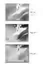 Fig. 07 - METHODS OF TREATING STROKE THROUGH ADMINISTRATION OF CTX0E03 CELLS