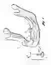 Fig. 02 - Method for preparing an implant site and laterally inserting a dental implant