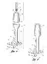 Fig. 03 - Method for preparing an implant site and laterally inserting a dental implant