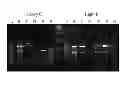 Fig. 02 - Composition for cancer prognosis prediction comprising anti-TMAP/CKAP2 antibodies