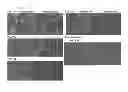 Fig. 08 - Composition for cancer prognosis prediction comprising anti-TMAP/CKAP2 antibodies