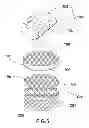 Fig. 06 - Surface cleaning system and method