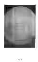 Fig. 06 - Stabilized crystal of 2-ethyl-3,7-dimethyl-6-(4-(trifluoromethoxy)phenoxy)quinoline-4-yl methyl carbonate, process for producing the crystal, and agricultural chemical composition comprising the crystal