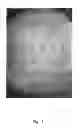 Fig. 08 - Stabilized crystal of 2-ethyl-3,7-dimethyl-6-(4-(trifluoromethoxy)phenoxy)quinoline-4-yl methyl carbonate, process for producing the crystal, and agricultural chemical composition comprising the crystal
