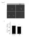 Fig. 28 - Compositions and Methods for Enhancing Proteasome Activity