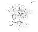 Fig. 02 - Non-invasive diagnostics for ventricle assist device