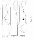 Fig. 16 - METHOD OF ANALYZING AND PROCESSING SIGNALS