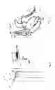 Fig. 02 - Arrhythmia Classification