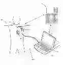 Fig. 01 - Systems and methods for setting parameters of implantable medical devices using predictive marker data