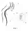 Fig. 02 - Lip enhancement and enlargement device
