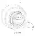 Fig. 09 - Lip enhancement and enlargement device
