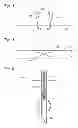 Fig. 03 - BODY LUMEN OCCLUSION APPARATUS AND METHODS