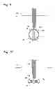 Fig. 05 - BODY LUMEN OCCLUSION APPARATUS AND METHODS