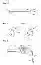 Fig. 10 - BODY LUMEN OCCLUSION APPARATUS AND METHODS