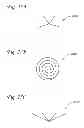 Fig. 12 - BODY LUMEN OCCLUSION APPARATUS AND METHODS