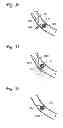 Fig. 14 - BODY LUMEN OCCLUSION APPARATUS AND METHODS